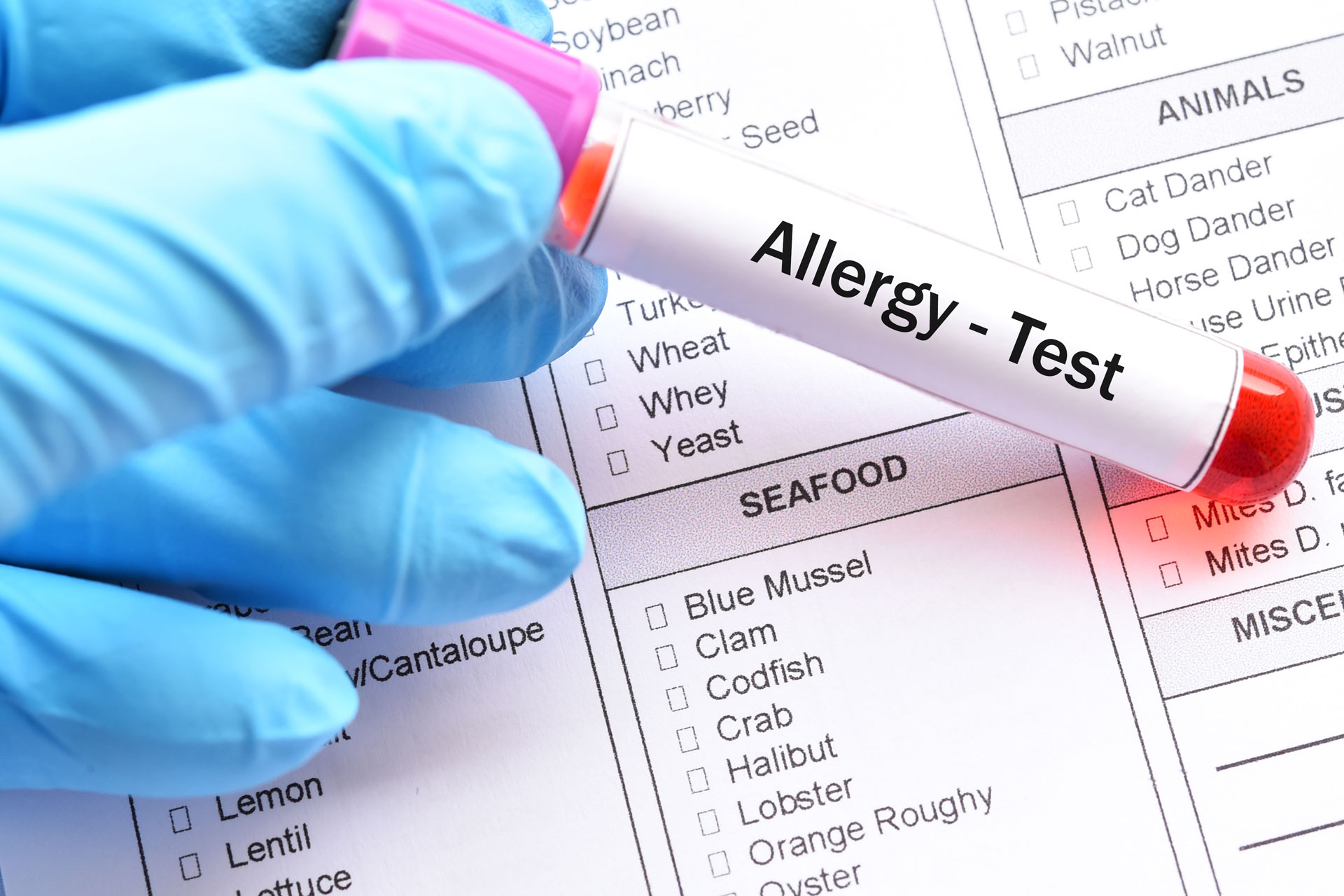 Kansas City Allergy Asthma Associates Allergy Skin Testing